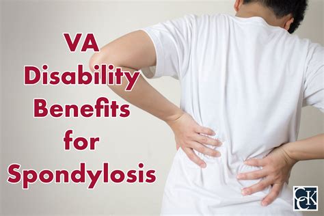 The two main surgical treatments for lumbar degenerative disk disease are lumbar fusion traditional standard surgical treatment and lumbar disk arthroplasty, also known as lumbar total. . Va disability rating for lumbar spondylosis